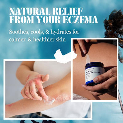 The Ocean Saved My Eczema Cream