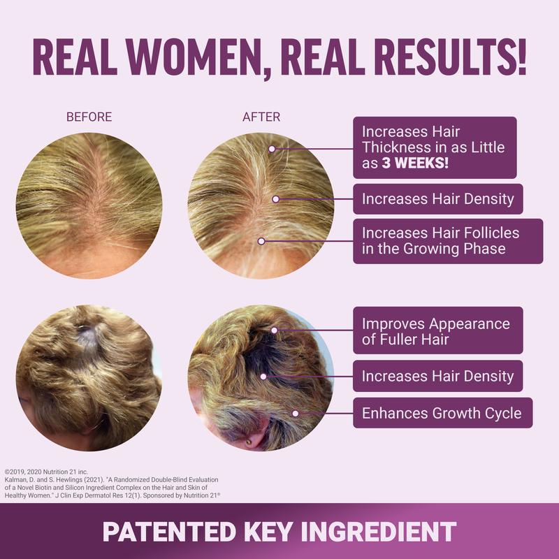 ForceFactor® Hair Growth Accelerator