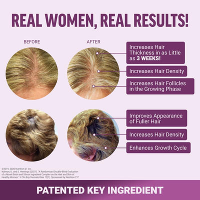 ForceFactor® Hair Growth Accelerator